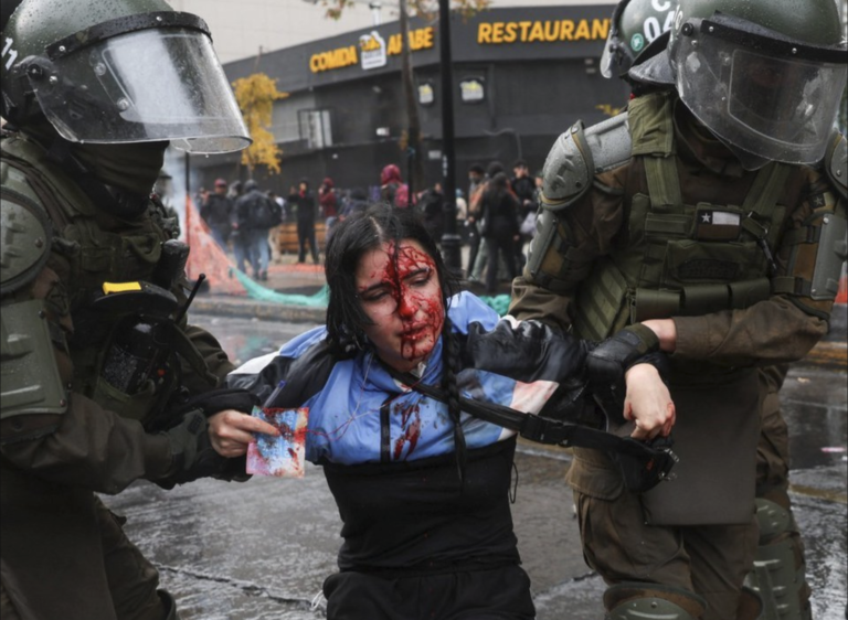 Acusaron represión policial en el caso de la estudiante herida en la marcha Confech, pero la autoría sigue sin probarse